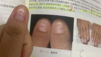 女生从教科书上发现自己生病了：学医最有用的一次